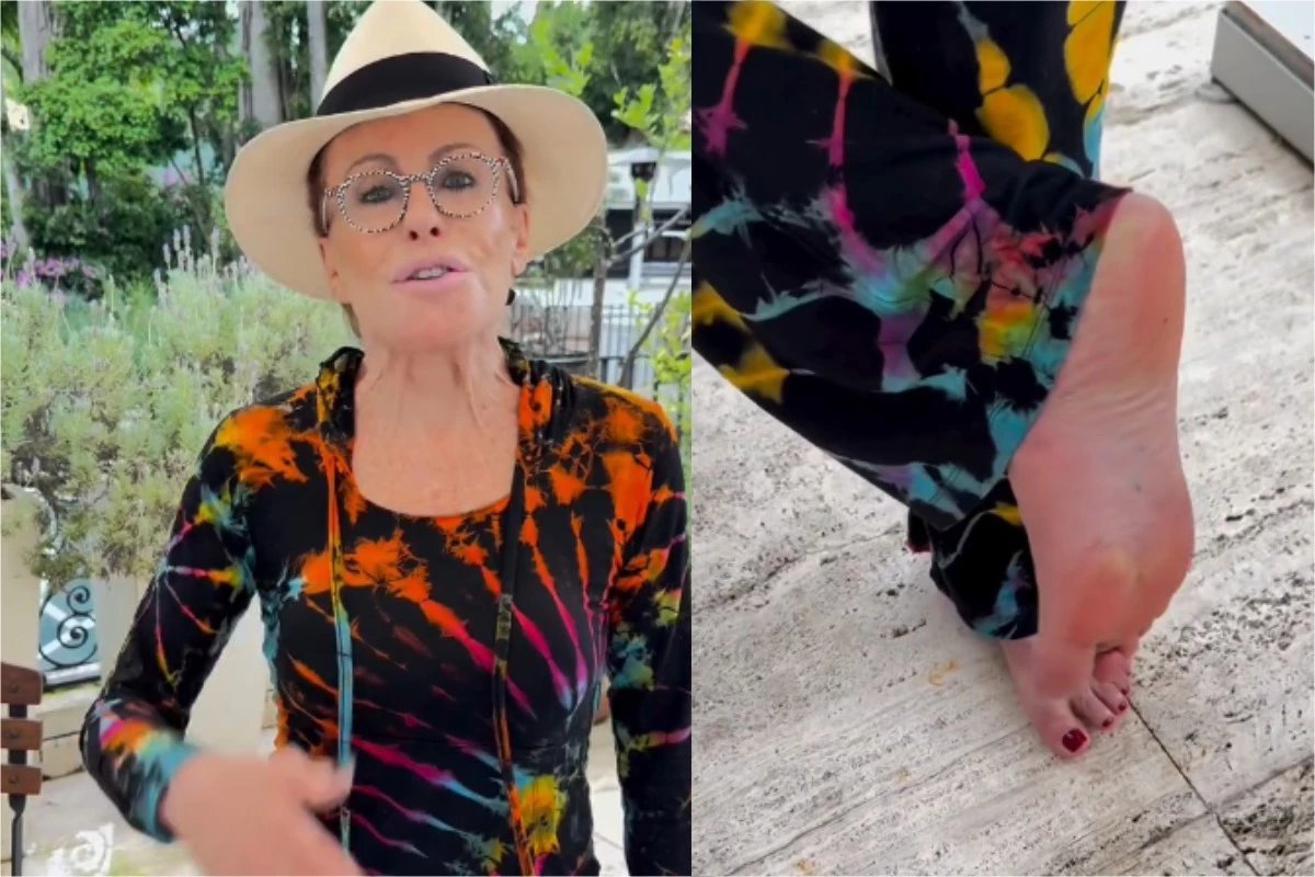 ‘Olhem so a minha situacao apos picada de escorpiao Ana