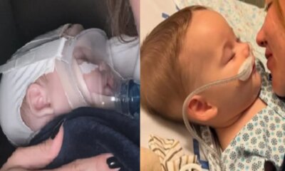 Bronquiolite filho de Virginia e internado com doenca e precisa