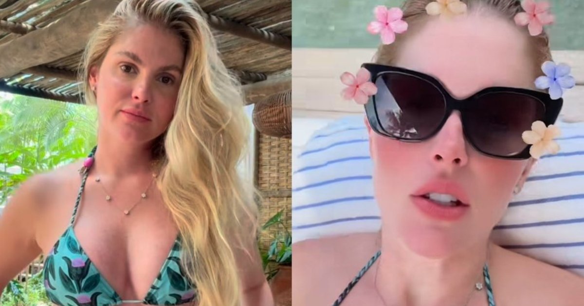Especialista explica motivo do umbigo de Bárbara Evans causar estranheza pelo formato após cirurgia plástica: 'Cicatriz' 31 Especialista explica motivo do umbigo de Barbara Evans causar estranheza