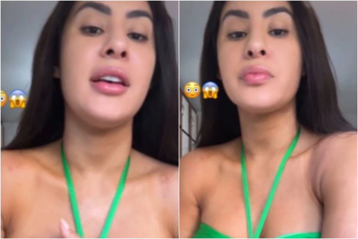 Isabelle surge machucada nas redes sociais e expoe tudo o