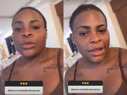 Jojo Todynho detalha procedimento feito nas pernas: “O resultado é incrível” 31 Jojo Todynho detalha procedimento feito nas pernas O resultado e