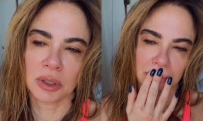 Luciana Gimenez ‘abusa no Carnaval e acaba passando por cirurgia