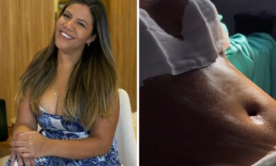 Mani Reggo passa por transformacao apos cirurgias plasticas video mostra