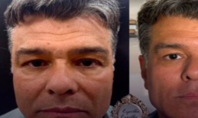Mauricio Mattar aparece bem diferente apos fazer harmonizacao facial veja