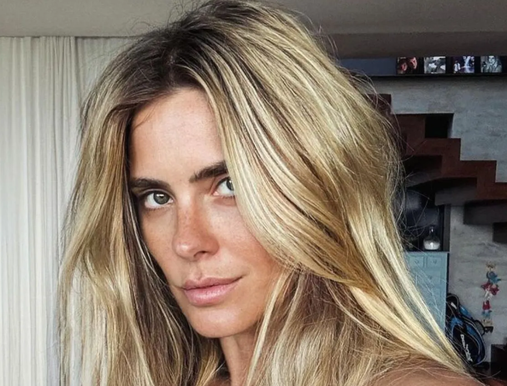 Médico explica cirurgia de explante de Carolina Dieckmann 37 Carolina Dieckmann (Foto Reprodução Redes Sociais)