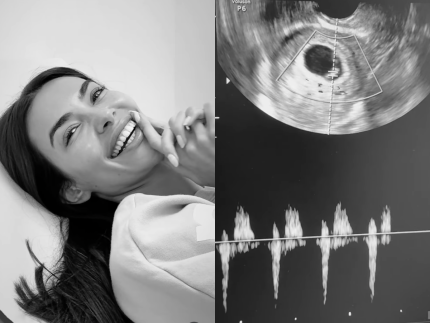 Mulher de Daniel Alves, Joana Sanz anuncia que está grávida 31 Mulher de Daniel Alves Joana Sanz anuncia que esta gravida