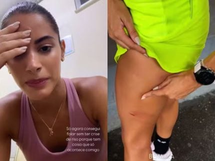 Que perigo! Atriz da Globo é atacada por cinco cães de rua durante gravação 31 Que perigo Atriz da Globo e atacada por cinco caes