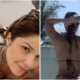 Samara Felippo faz procedimento no bumbum e mostra o resultado