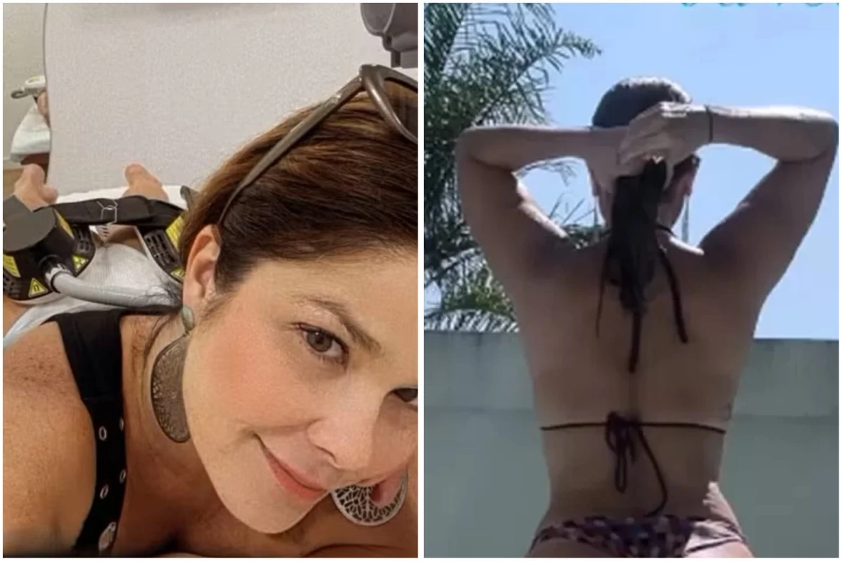 Samara Felippo faz procedimento no bumbum e mostra o resultado: ‘Bora turbinar a raba’ 33 Samara Felippo faz procedimento no bumbum e mostra o resultado