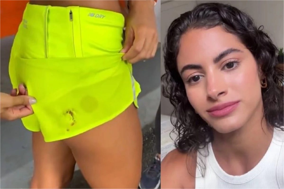 Vídeo: atriz da Globo é atacada por cachorros durante gravações de novela e vai parar no hospital 33 Video atriz da Globo e atacada por cachorros durante gravacoes