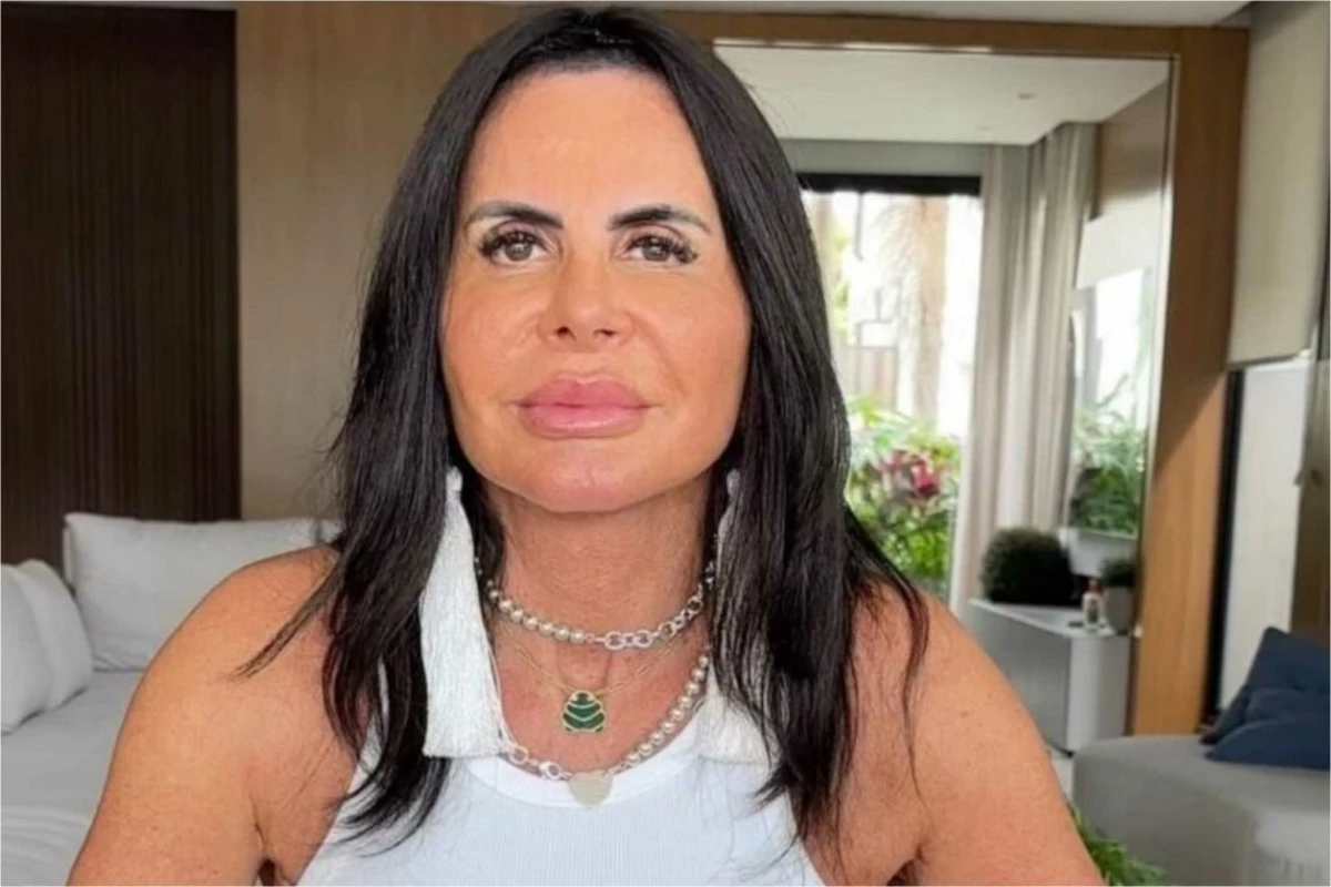 ‘Hoje vamos dar um retoque na parte da frente’, diz Gretchen, após preenchimento no bumbum 31 ‘Hoje vamos dar um retoque na parte da frente diz