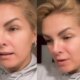 Ana Hickmann recebe dura critica e expoe diagnostico de doenca ‘resolvi