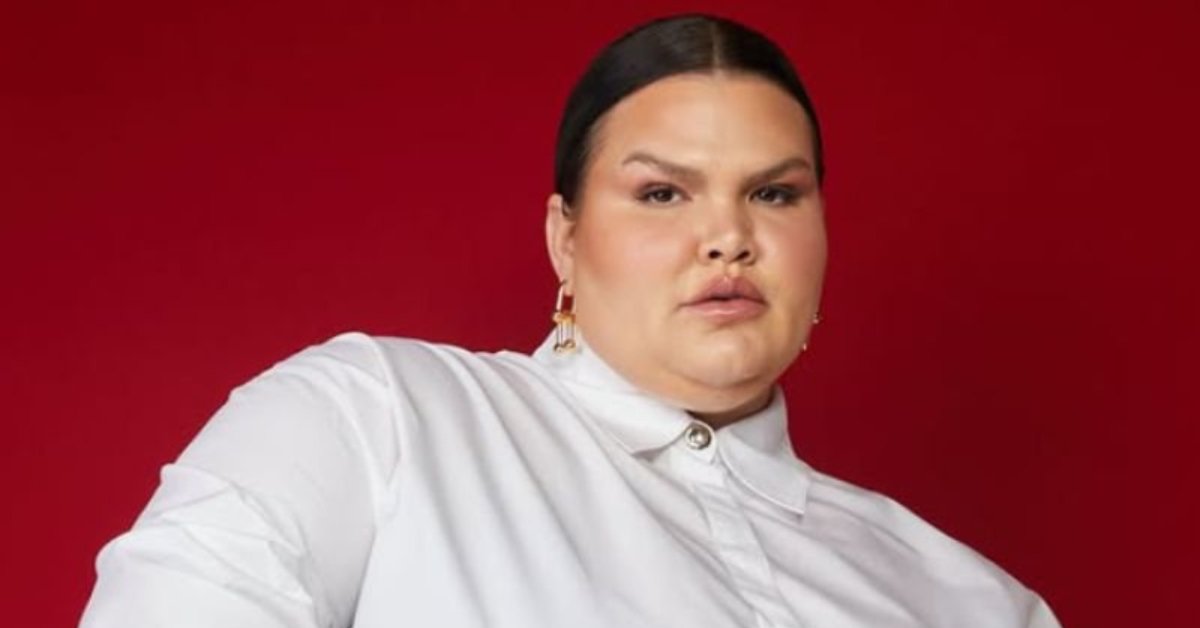 Apos perder 30 kg Thais Carla passa por cirurgia bariatrica