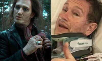Ator de Harry Potter corre risco de perder movimentos e