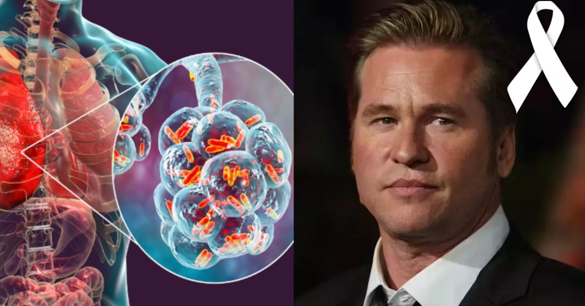 Estes são os sintomas da doença que tirou a vida do astro de Hollywood Val Kilmer 31 Estes sao os sintomas da doenca que tirou a vida