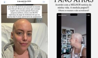 Fabiana Justus celebra um ano de transplante de medula ossea