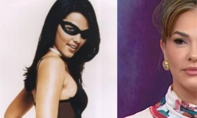 Lembra da Tiazinha Atriz passou por harmonizacao facial e revelou
