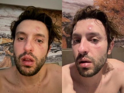 Produtor de Hollywood é acusado de fazer ritual de agressão contra Haysam Ali, ex-Fazenda de Verão 31 Produtor de Hollywood e acusado de fazer ritual de agressao