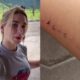 Virginia Fonseca machuca a perna durante passeio em familia Estamos