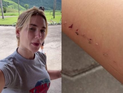 Virginia Fonseca machuca a perna durante passeio em família: “Estamos bem” 31 Virginia Fonseca machuca a perna durante passeio em familia Estamos