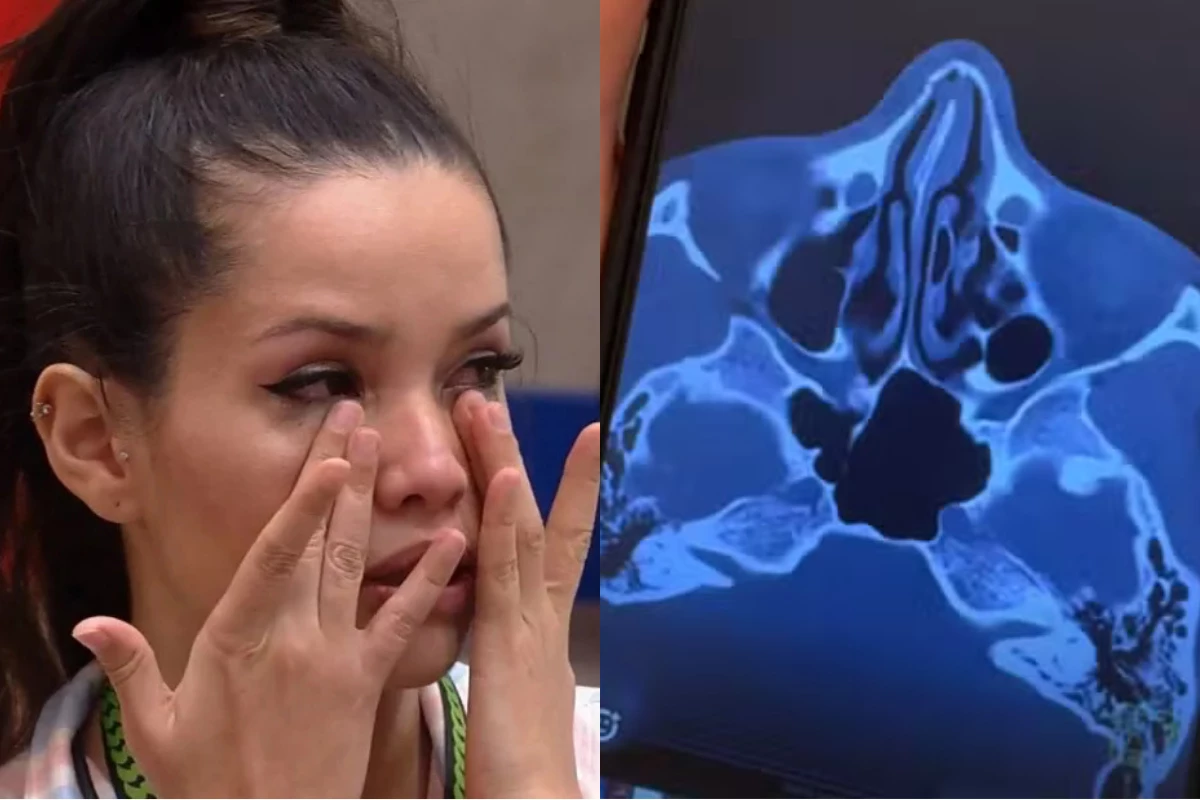 A bruxa está solta! Juliette revela o que aconteceu com seu rosto após acidente em casa 33 A bruxa esta solta Juliette revela o que aconteceu com