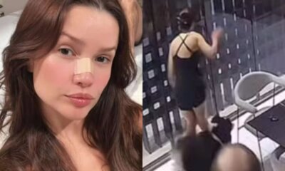 Apos microfratura Juliette vive novo susto com porta de vidro