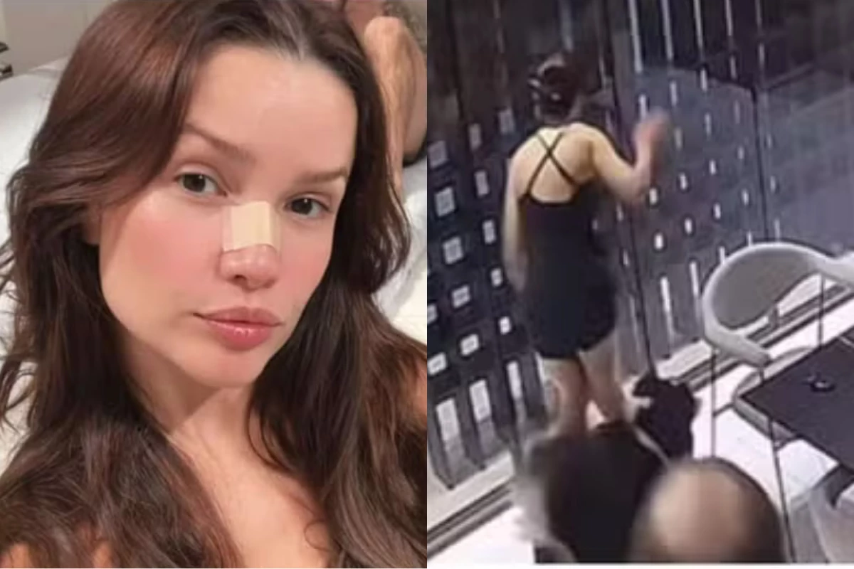 Após microfratura, Juliette vive novo susto com porta de vidro 33 Apos microfratura Juliette vive novo susto com porta de vidro