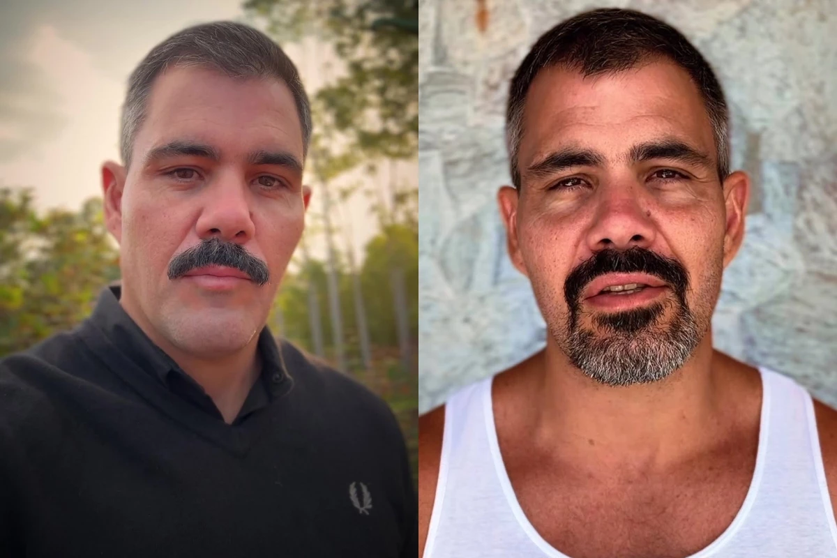 Após nova internação de Maria Guilhermina, Juliano Cazarré passa por cirurgia e conta com o apoio da esposa 31 Apos nova internacao de Maria Guilhermina Juliano Cazarre passa por