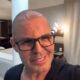 Apos procedimento Eduardo Costa aparece careca em show