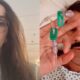 Apos susto Leticia Cazarre mostra um pouco de como esta