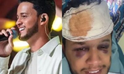 Cantor Hugo da dupla de Raphael sofre traumatismo craniano em