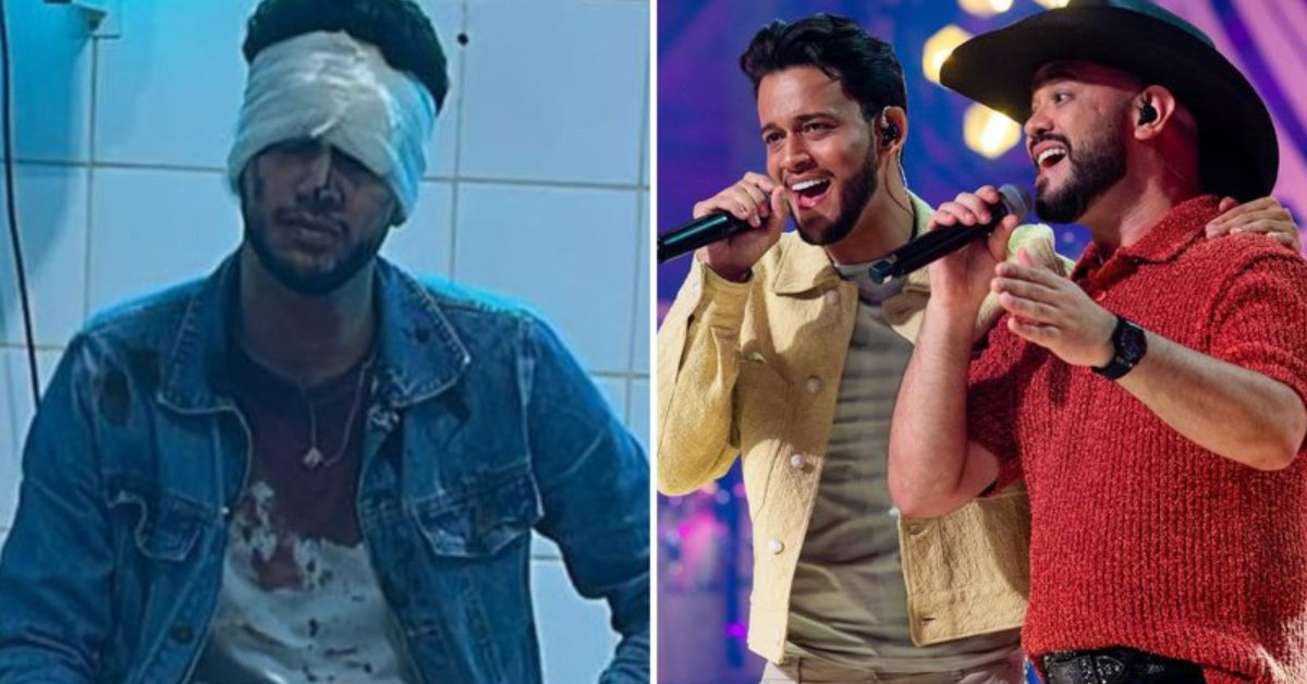 Cantor sertanejo sofre acidente após show e tem traumatismo craniano: 'Não consigo' 31 Cantor sertanejo sofre acidente apos show e tem traumatismo craniano