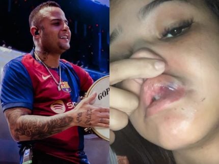 Caso Didico: ex-Pagode do Adame acusado de agredir ex-namorada se pronuncia 31 Caso Didico ex Pagode do Adame acusado de agredir ex namorada se
