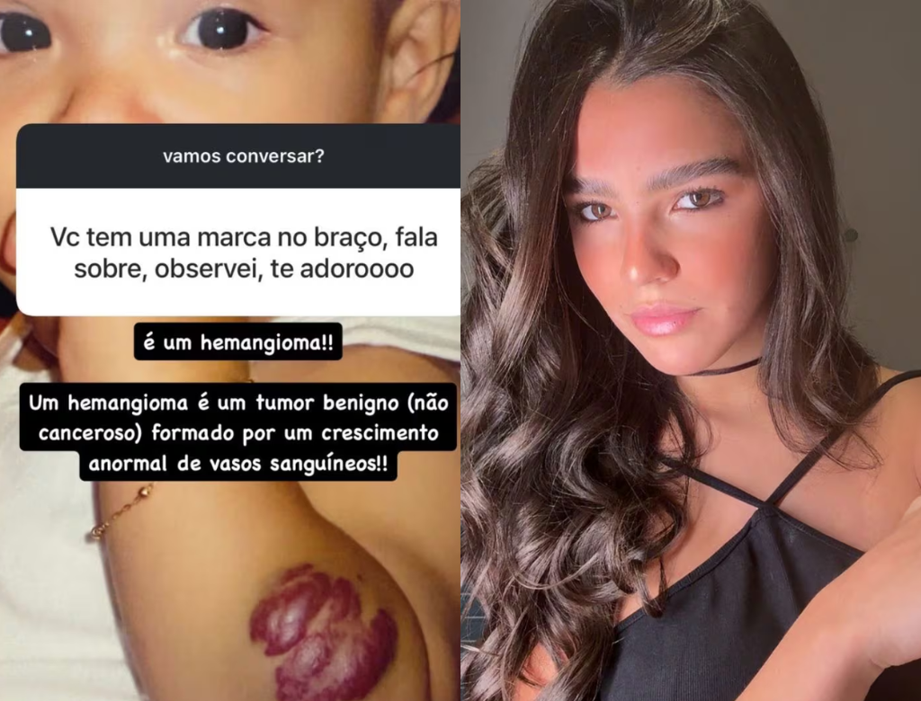 Duda Guerra, ex de Benício Huck, revela diagnóstico de tumor: ‘Anormal’ 35 Duda Guerra (foto Reprodução Redes Sociais)