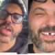 Edson perde dente antes de show e Hudson nao perdoa