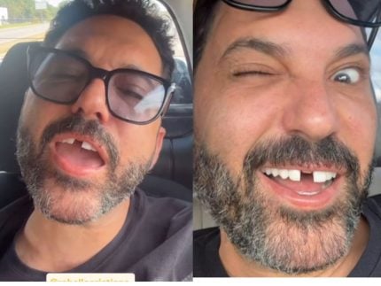 Edson perde dente antes de show e Hudson não perdoa: “Onde tem um dentista urgente?” 31 Edson perde dente antes de show e Hudson nao perdoa