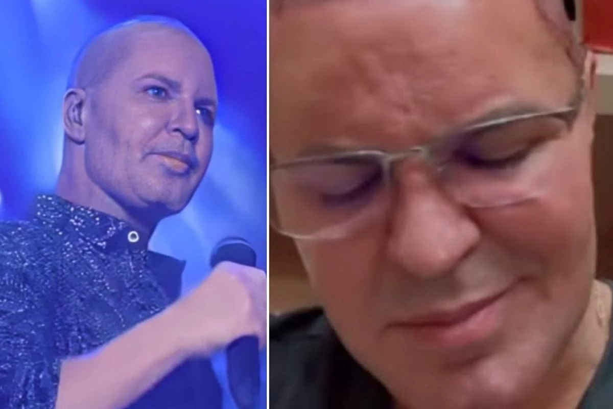 Eduardo Costa vem a público e conta a verdade após surgir careca em show: ‘As pessoas têm que saber’ 31 Eduardo Costa vem a publico e conta a verdade apos