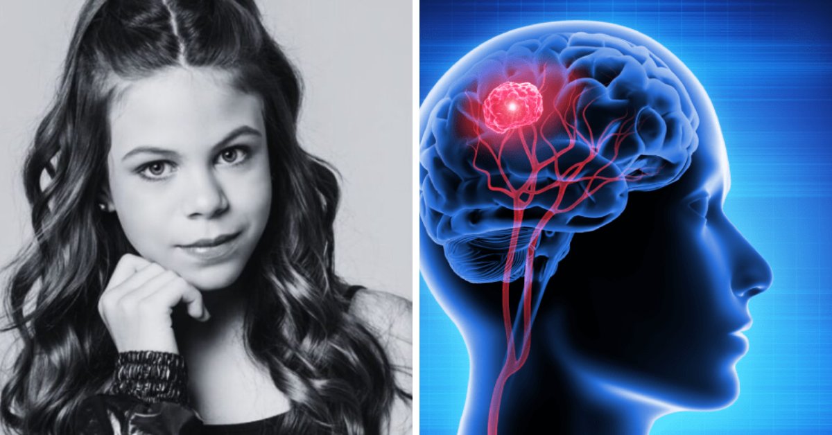 Estes são os sintomas que não devem ser ignorados e que indicam tumor cerebral, doença que causou morte da atriz mirim do SBT 31 Estes sao os sintomas que nao devem ser ignorados e