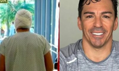 Ex jogador da Selecao sofre queimaduras e passa por duas cirurgias