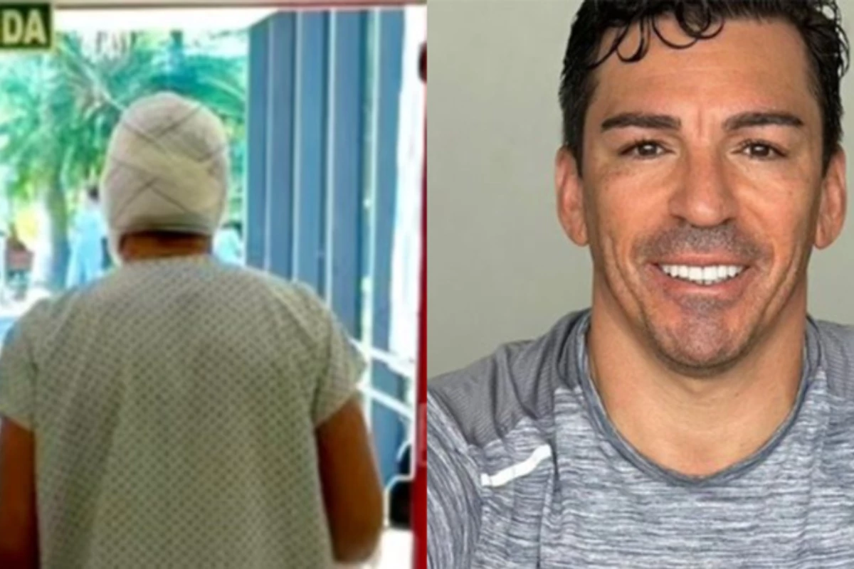 Ex-jogador da Seleção sofre queimaduras e passa por duas cirurgias; ele teve um acidente doméstico 31 Ex jogador da Selecao sofre queimaduras e passa por duas cirurgias