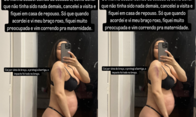 Gravida Raissa Barbosa cai da escada e vai a emergencia