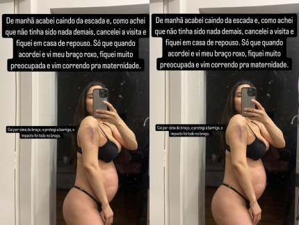 Grávida, Raissa Barbosa cai da escada e vai à emergência do hospital: “Preocupada” 31 Gravida Raissa Barbosa cai da escada e vai a emergencia