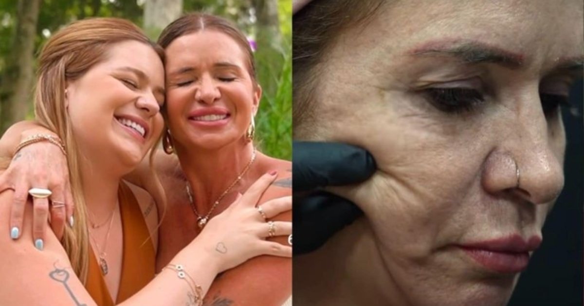 Mãe de Viih Tube impressiona com 'antes e depois' de cirurgia no rosto: "Minha melhor versão" 31 Mae de Viih Tube impressiona com antes e depois de