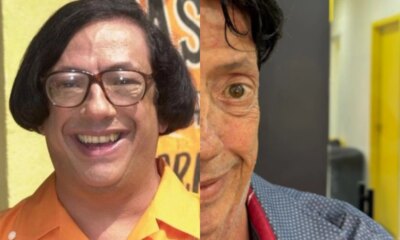 Marcos Oliveira o Beicola aparece com novo visual apos procedimento