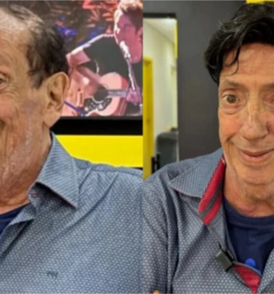 Marcos Oliveira o eterno Beicola passa por procedimento e aparece
