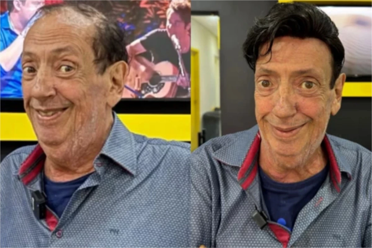 Marcos Oliveira, o eterno Beiçola, passa por procedimento e aparece com novo visual 33 Marcos Oliveira o eterno Beicola passa por procedimento e aparece