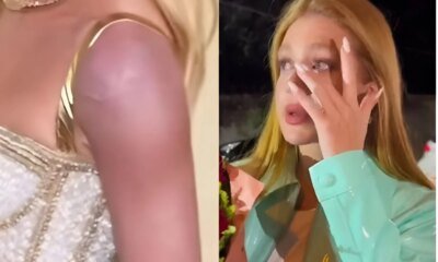 Marina Ruy Barbosa aparece com braco roxo e se justifica