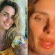 Novo procedimento Carolina Dieckmann aparece com labios inchados e medico