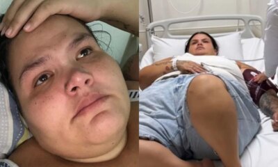 O lado oculto da bariatrica especialista revela o que Thais