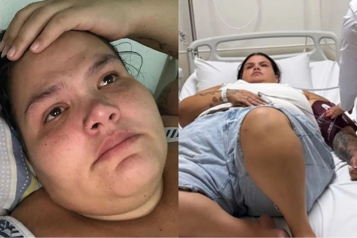 O lado oculto da bariátrica: especialista revela o que Thais Carla vai enfrentar após a cirurgia 31 O lado oculto da bariatrica especialista revela o que Thais